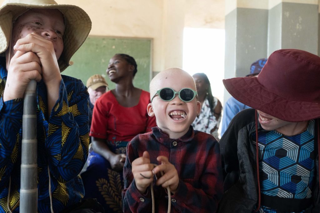 Albinismo en Malawi
