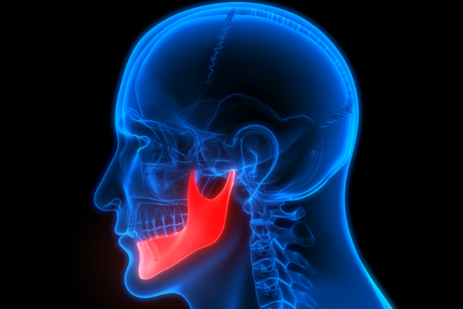 Trastornos de la articulación temporo-mandibular