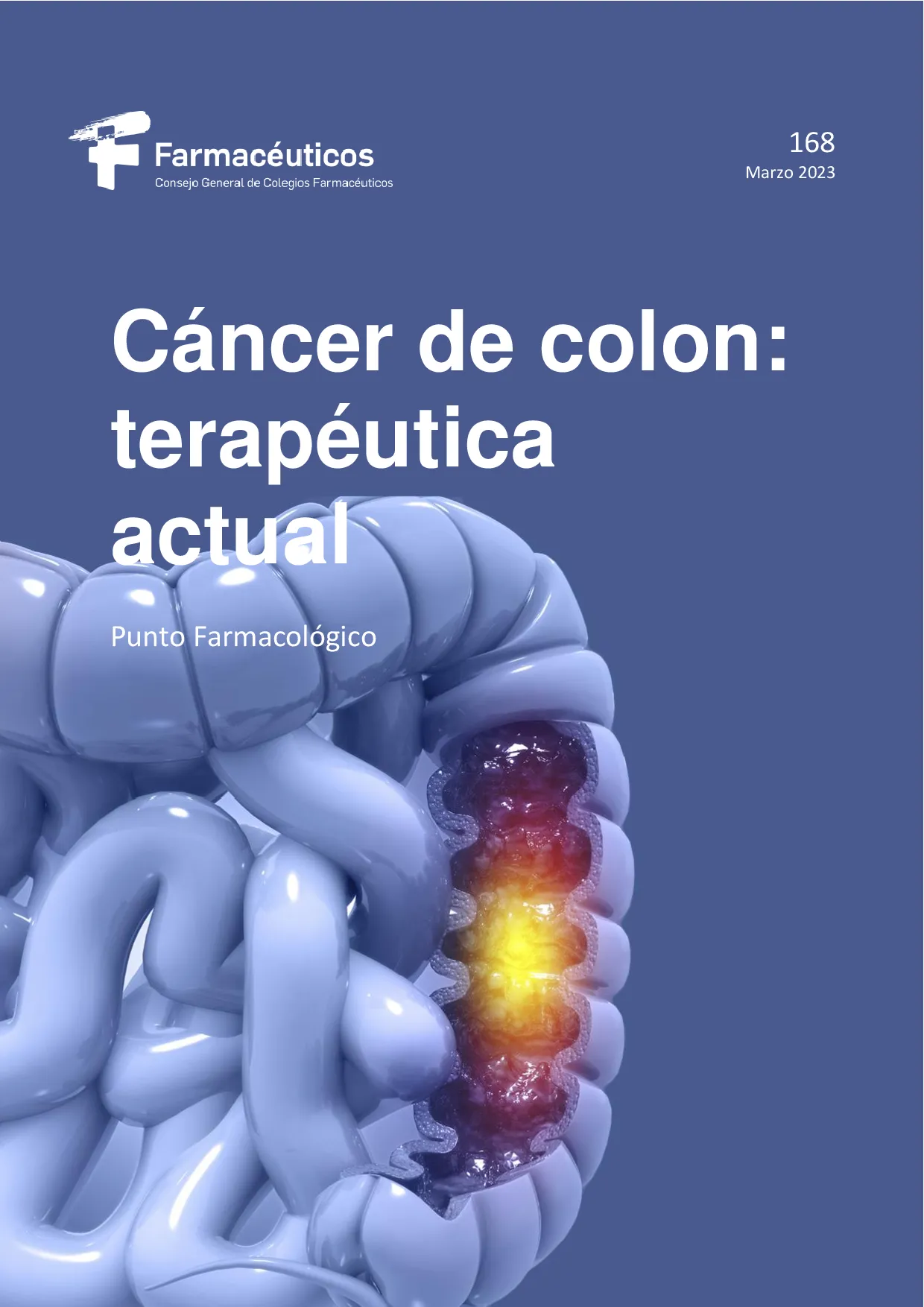 Cáncer de colon: terapéutica actual – Punto Farmacológico Nº 168