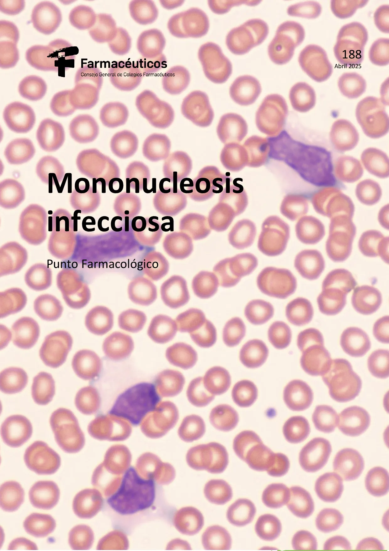 Mononucleosis infecciosa – Punto Farmacológico Nº 188