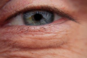 ojos-retinoides ojos