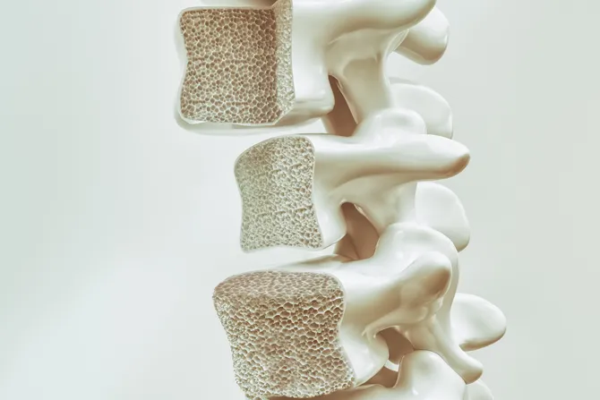 Osteoporosis