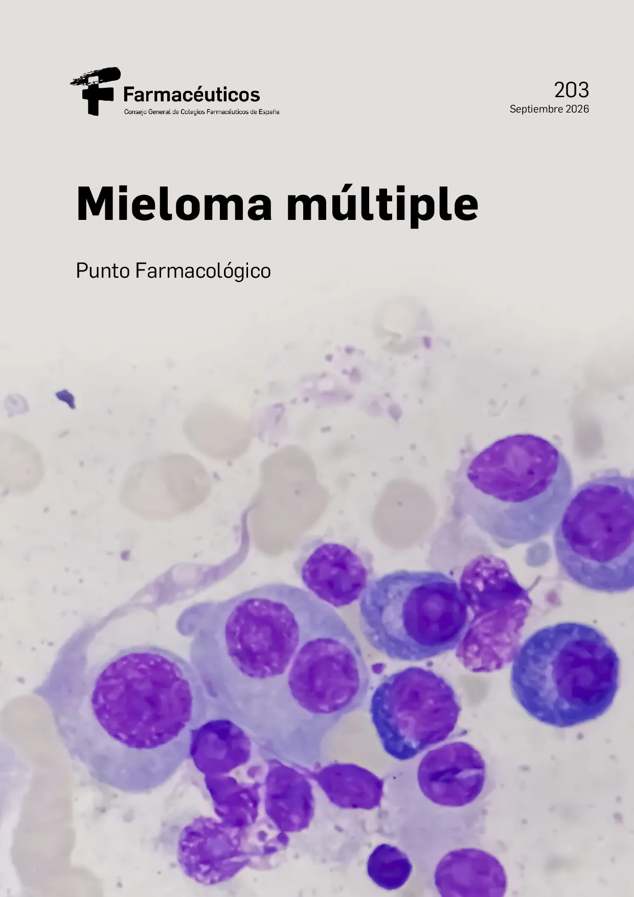 Mieloma múltiple – Punto Farmacológico N.º 203