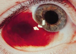 Revision-Traumatismos-oculares-01_grande