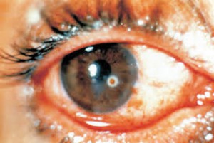 Revision-Traumatismos-oculares-03_grande