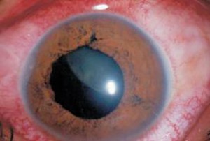 Revision-Traumatismos-oculares-04_grande