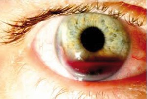 Revision-Traumatismos-oculares-05_grande