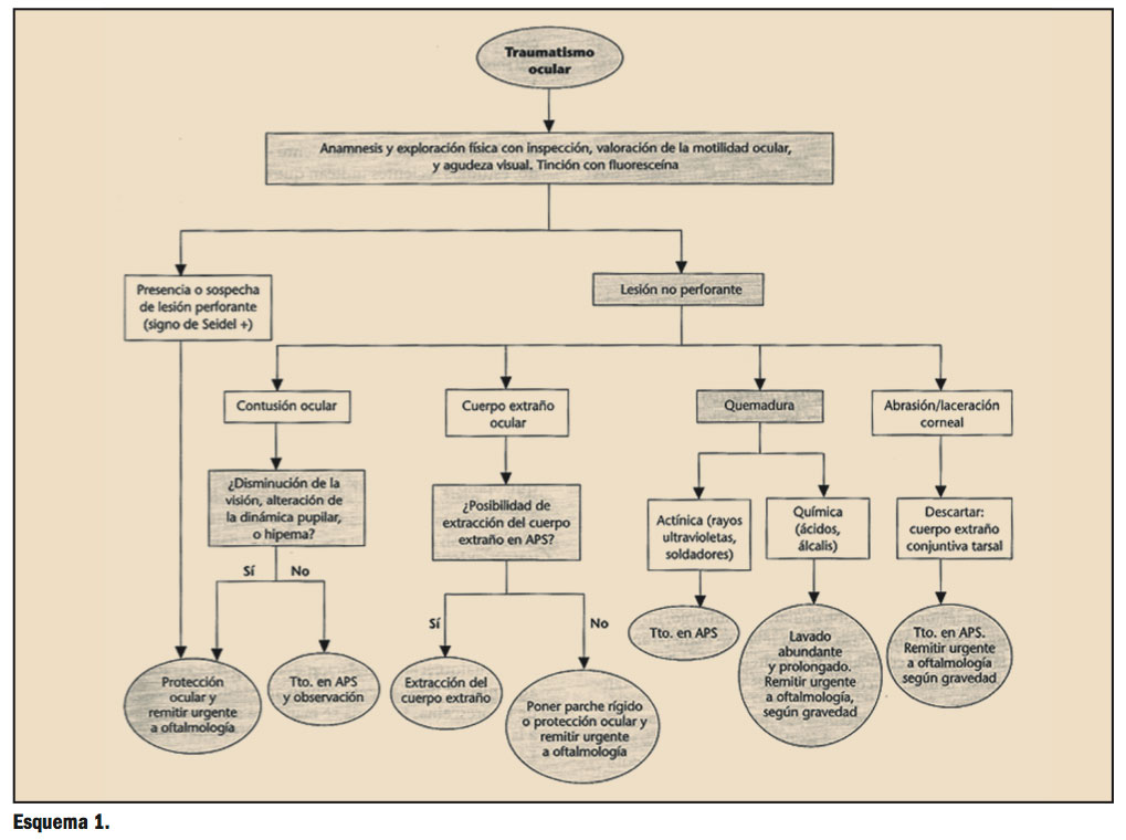 traumatismos-oculares-esquema1