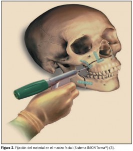 sistemas-biodegradables02