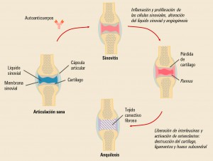 PAM_416_Sarilumab_F2