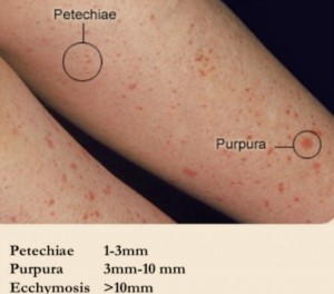 PAM_418__REVISION_2_F3