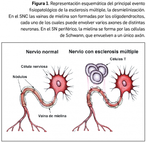 Revision_Esclerosis_Figura1