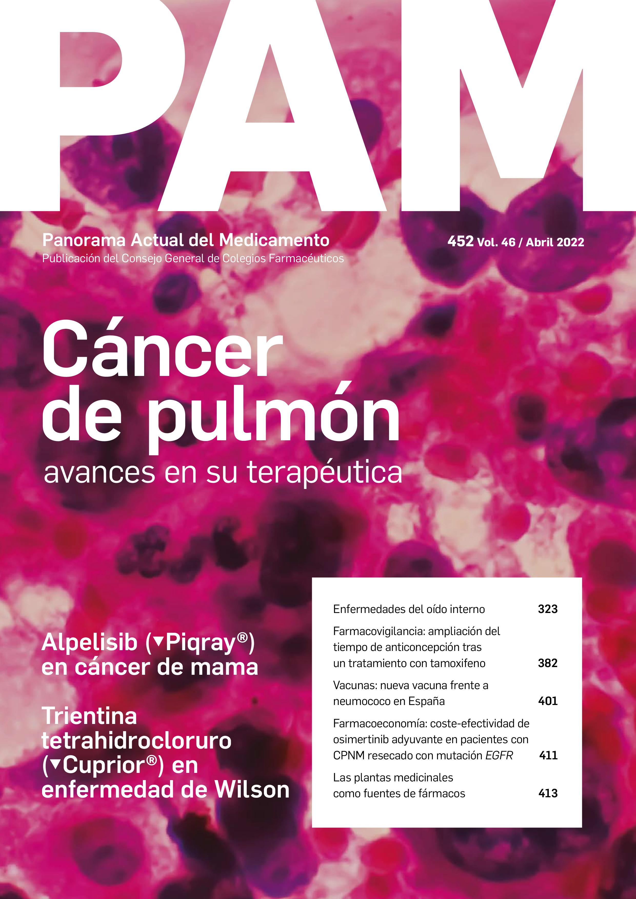 Nº452